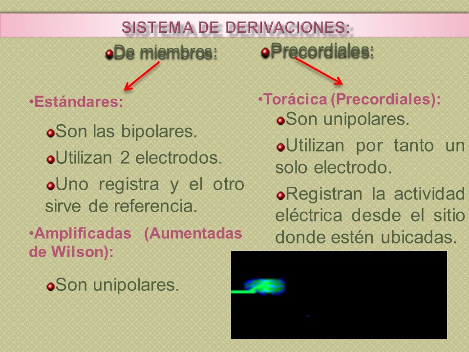 Las prostitutas sobre un pequeño miembro
